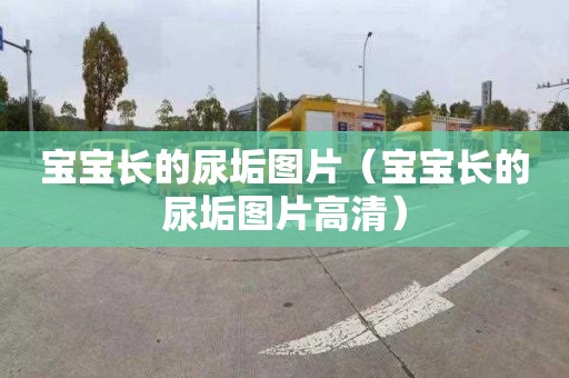 宝宝长的尿垢图片（宝宝长的尿垢图片高清）
