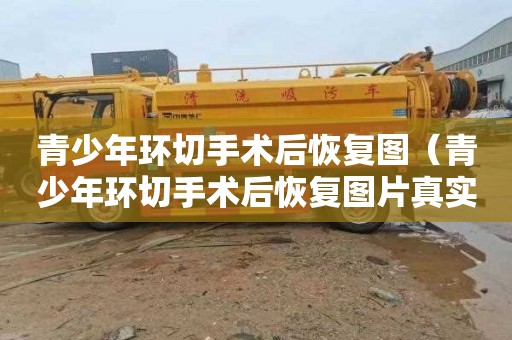 青少年环切手术后恢复图（青少年环切手术后恢复图片真实）
